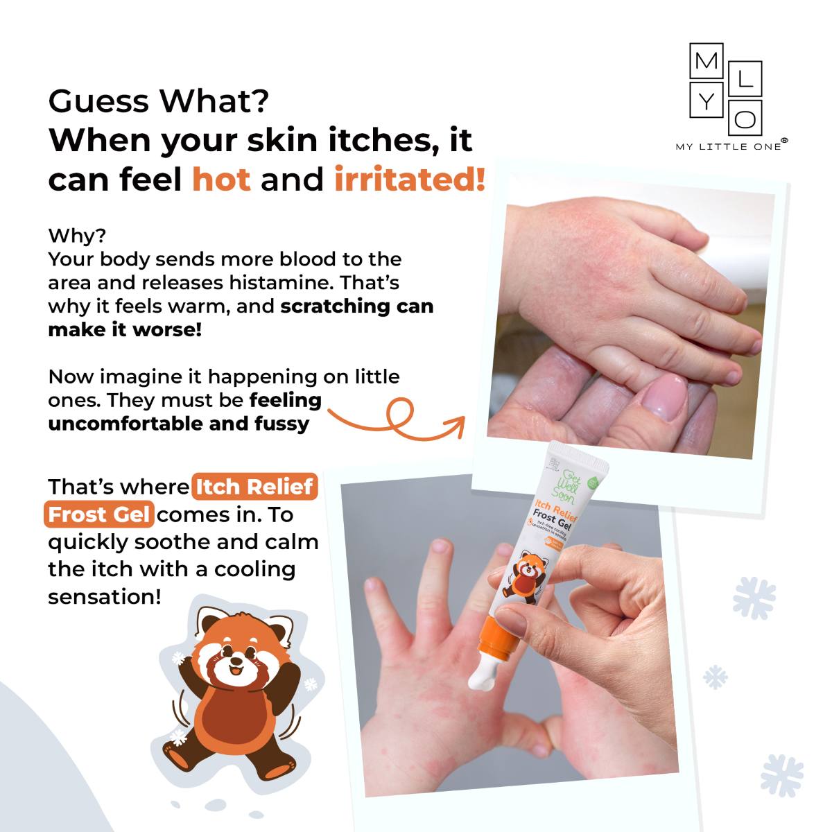 MyLO GWS Itch Relief Frost Gel (15g)