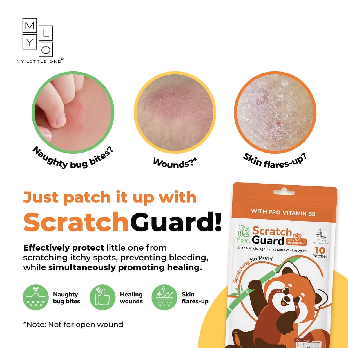 MyLO ScratchGuard Relief Patch (10 patches / pouch)